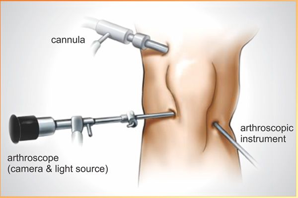 Arthroscopy Unit